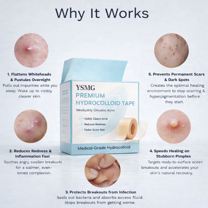 Hydrocolloid Healing Tape That Instantly Protects & Repairs Skin