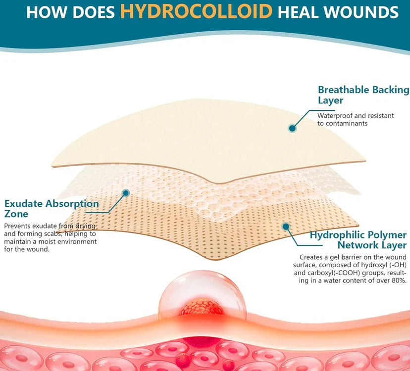Hydrocolloid Healing Tape That Instantly Protects & Repairs Skin